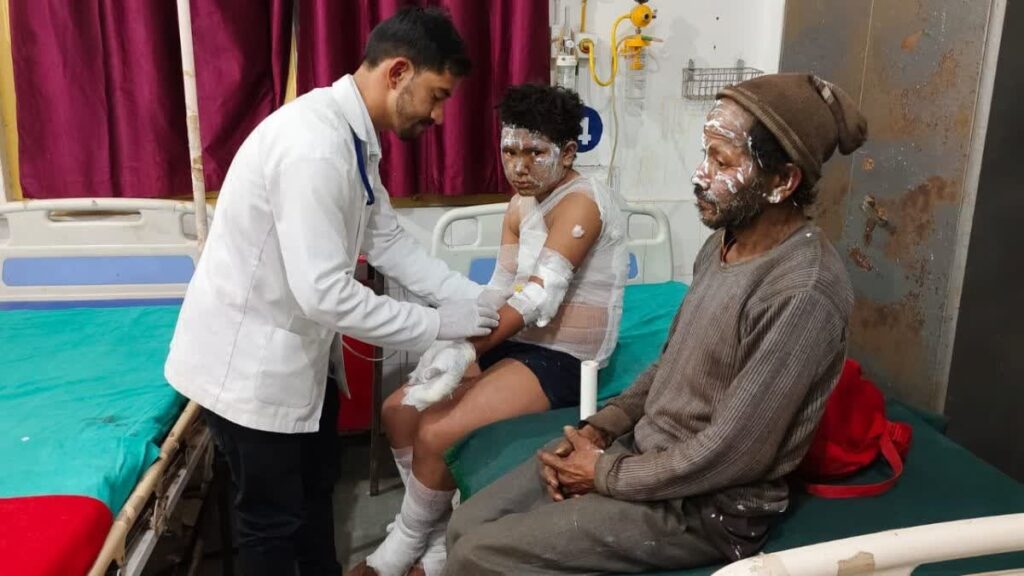 जंगल की आग ने लिया विकराल रूप, बाप-बेटा झुलसे